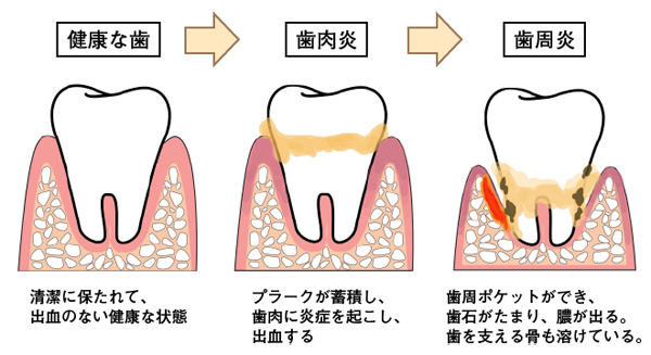 気づきにくいペットの歯周病とその予防 埼玉県さいたま市の入れ歯なら福永歯科医院